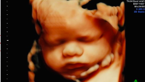 My Baby Debut 3D 4D HD Ultrasound