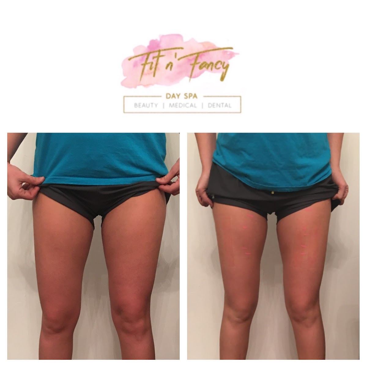 Fit & Fancy Med Spa & School