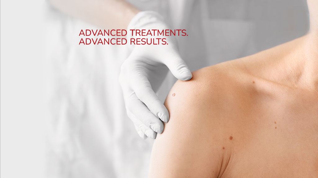 Advanced Dermatology Center