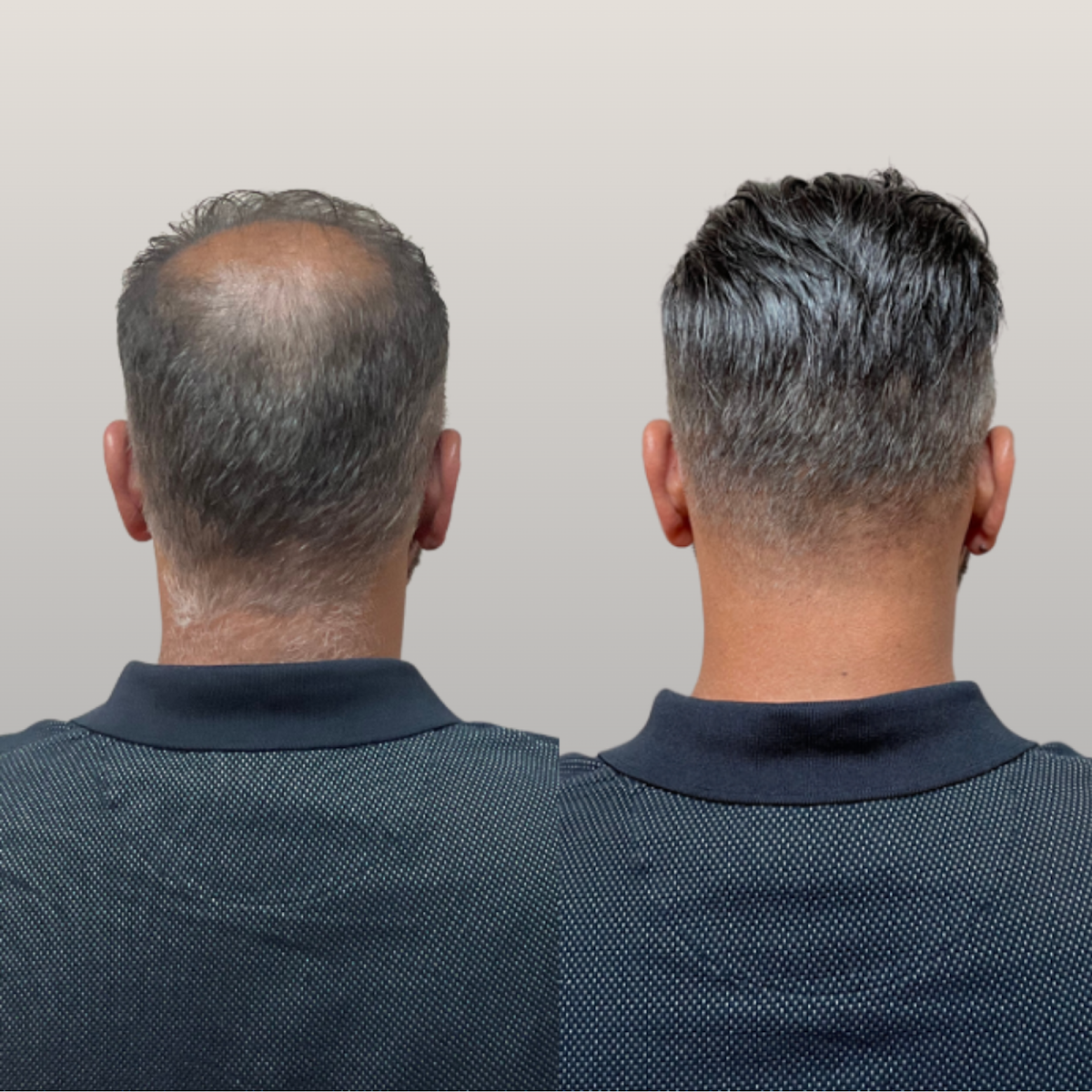 Jernigan's Hair Replacement Clinic