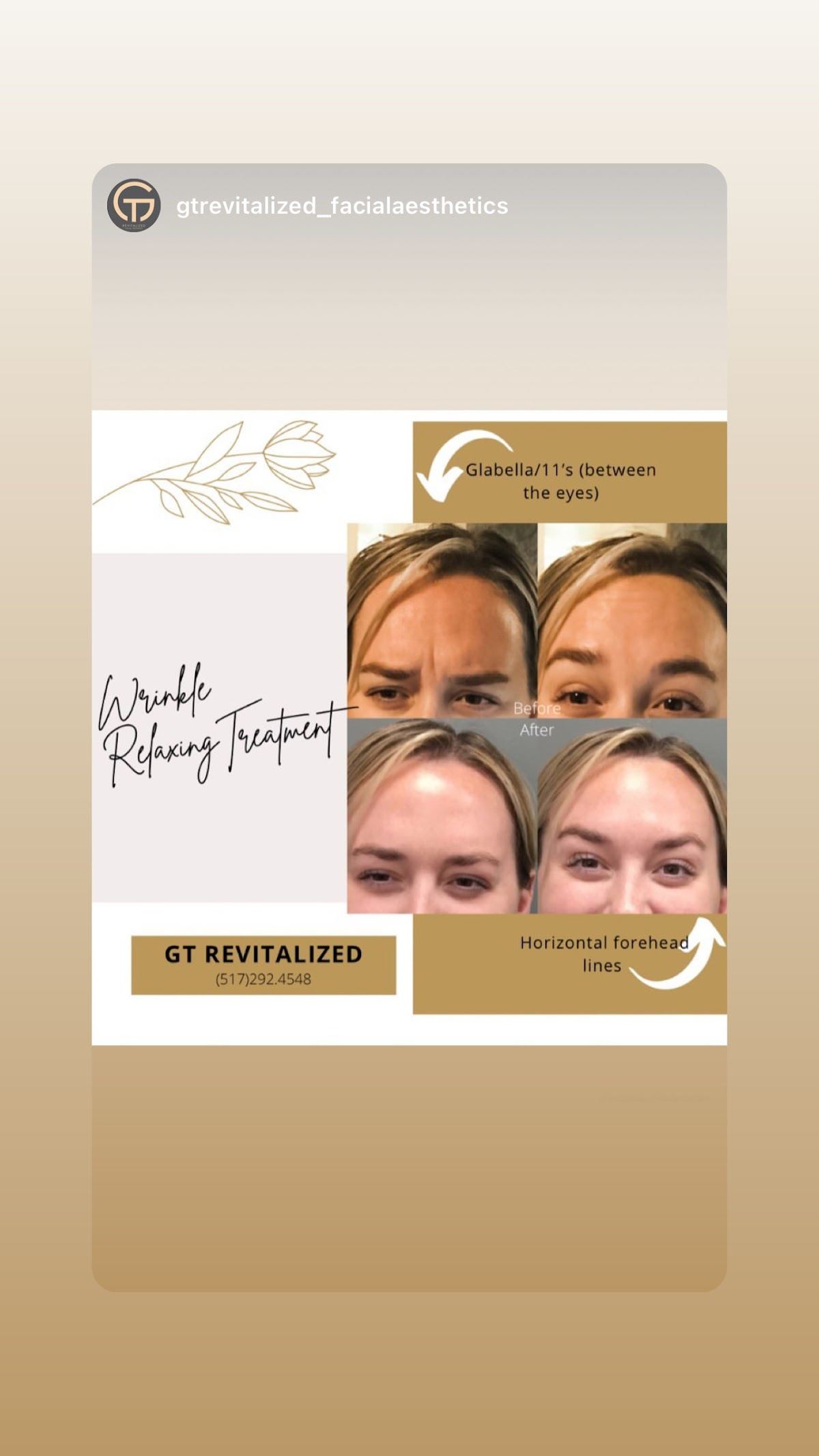 GT Revitalized Facial Aesthetics