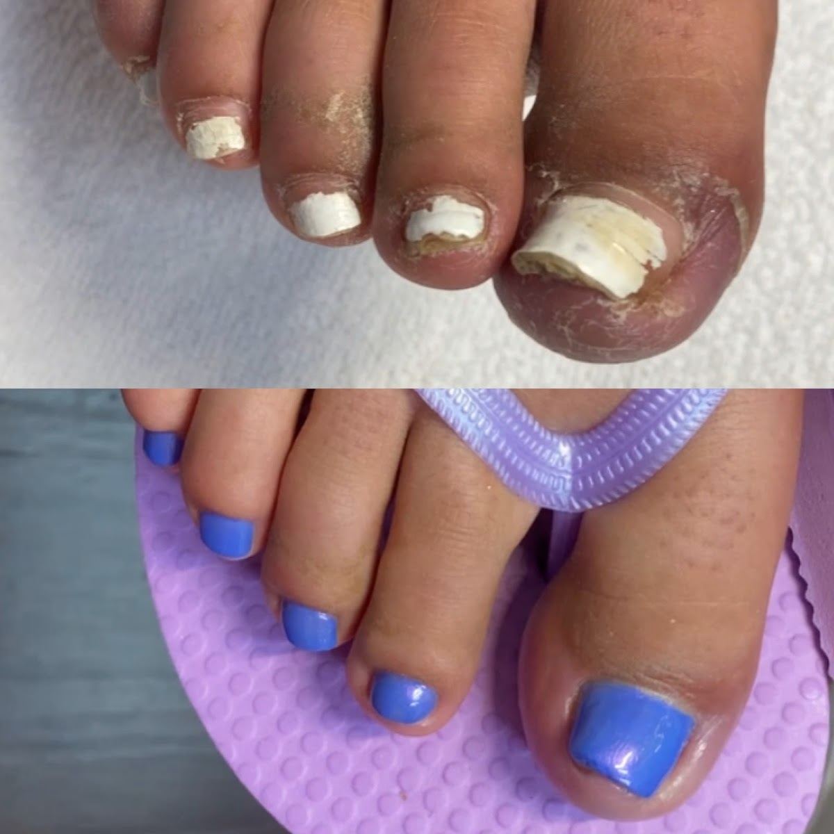 Medi Pedi Indy