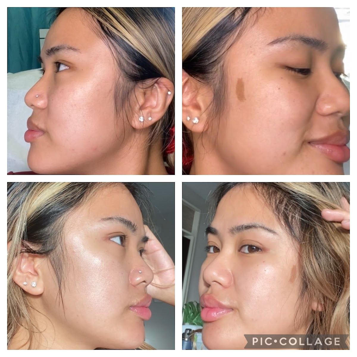 Rejuve Aesthetics & Wellness