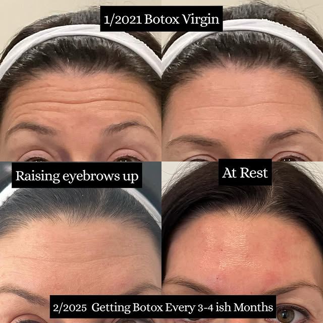 Novique Medical Aesthetics Bethlehem