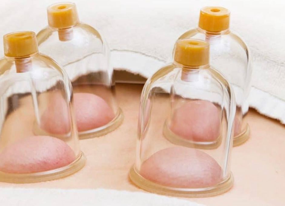 Pure Earth Healing Hijama Cupping Therapy Pennsylvania