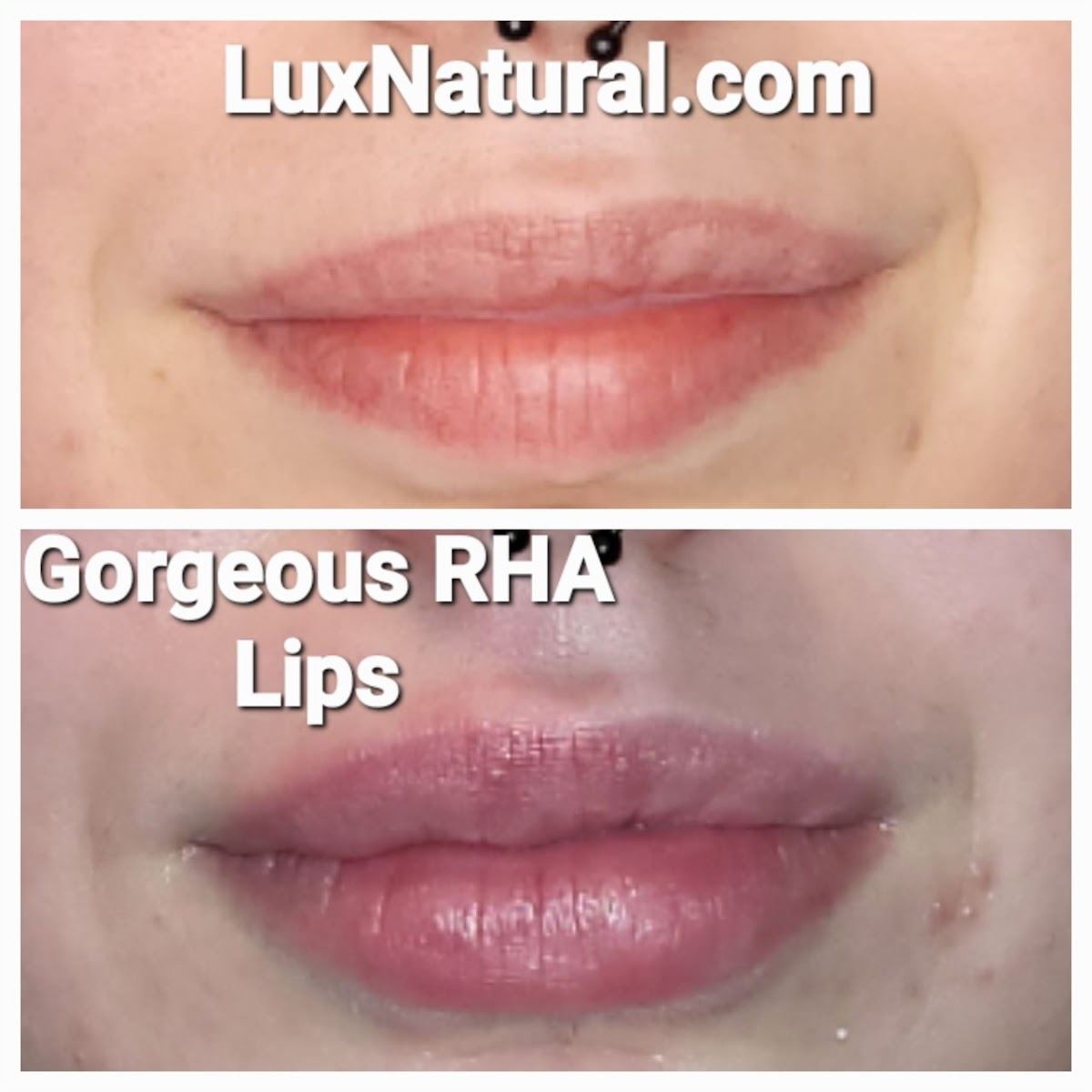 LUX AESTHETIC MEDSPA / CLAYTON, GEORGIA