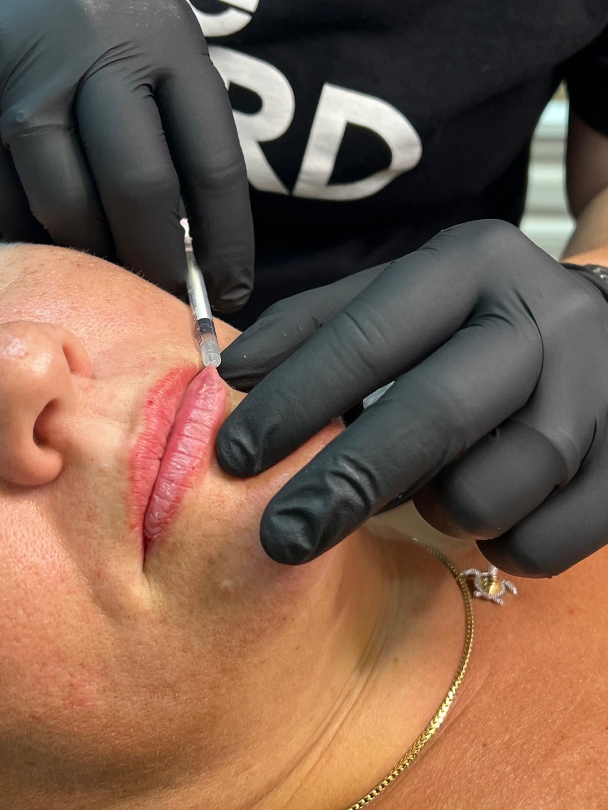 Bayshore Botox
