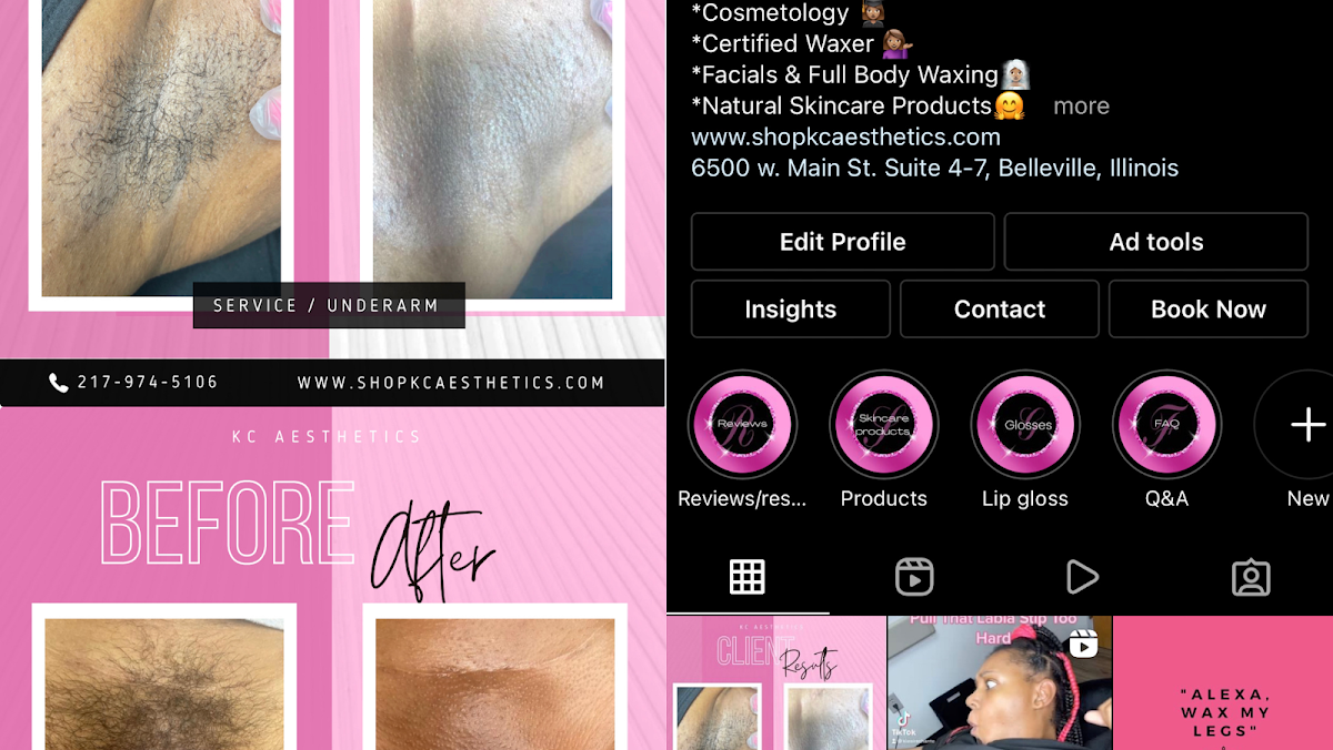KC Aesthetics LLC